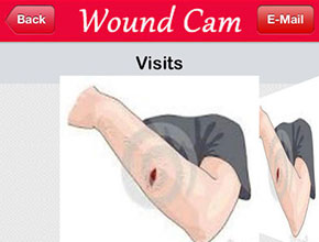 Webappmate Wound Cam supporting visual on the Portfolio page